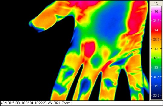 Infrarotaufnahme mit Temperaturskala