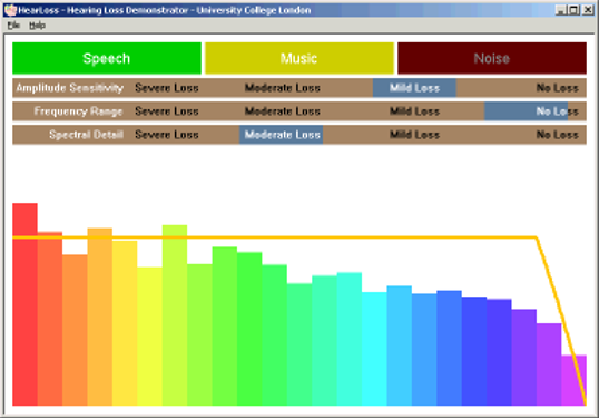 Das Bild zeigt die Oberfläche des Hörverlust-Demonstrators der University College London. Zu sehen sind die Bedienelemente mit einer grafischen Darstellung des Frequenzspektrums, in dem die Wirkung der über die Regler ausgewählten Filter grafisch angezeigt wird.