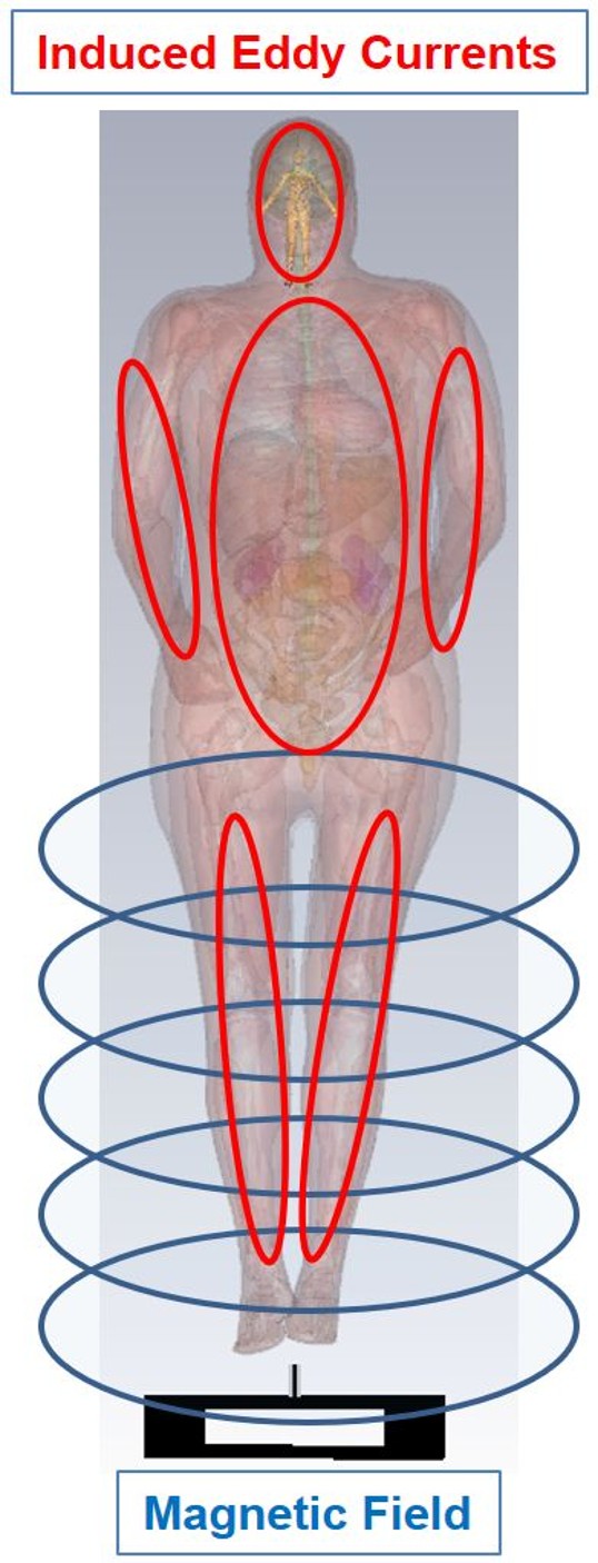 Anatomic sketch of a human body with indicated field lines und induced currents