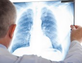 Foto: Ein Arzt betrachtet ein Röntgenbild