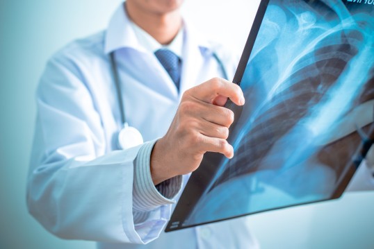 Arzt betrachtet Röntgenbilder