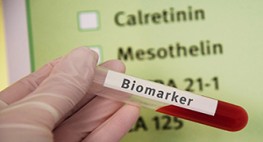 A hand holds a tube of blood in front of a form that lists calretinin, among other items.