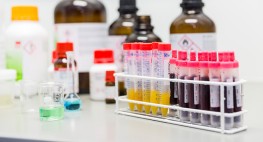 Various samples of urine and blood in a test tube rack.