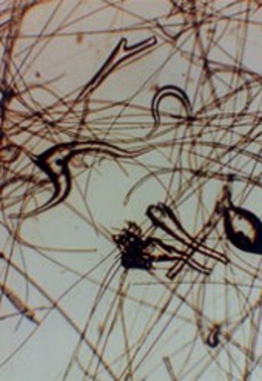 Mikroskopische Aufnahme Keramikfaser